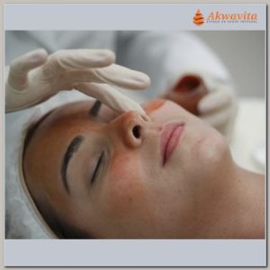 Peeling Vulcanice, fase em cabine