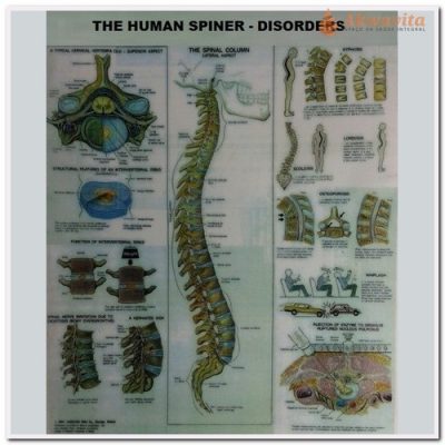 Poster The Human Spine Disorders Plastificado