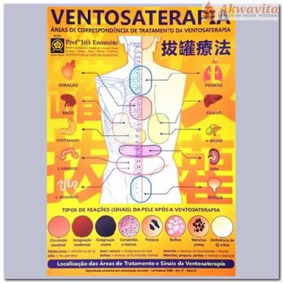 Mapa Para Ventosaterapia na MTC Enomóto Plastificado