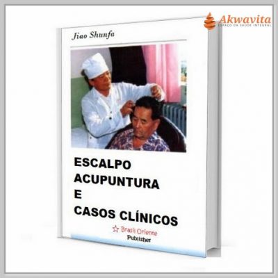 Escalpo Acupuntura e Casos Clínicos Jiao Shunfa
