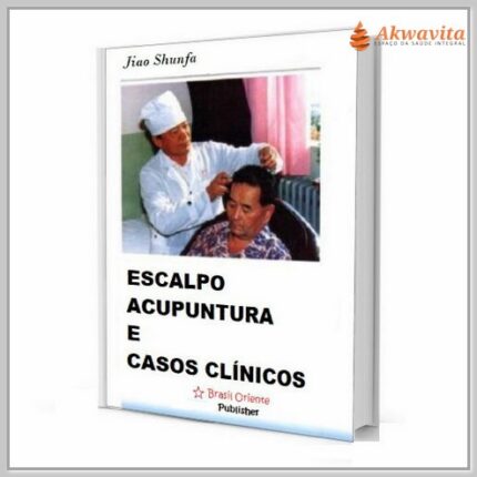 Escalpo Acupuntura e Casos Clínicos Jiao Shunfa