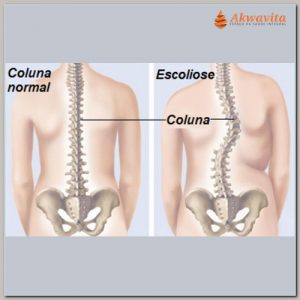 A Quiropraxia em Dores por Articulações Bloqueadas