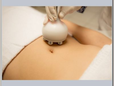 Celulite Gordura e Flacidez com Rádio Frequência