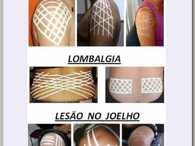 B Esparadrapoterapia Spiral e Kinesio Tira Dores