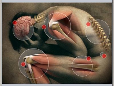 Fisioterapia Neurológica Nas Sequelas do Sistema Nervoso