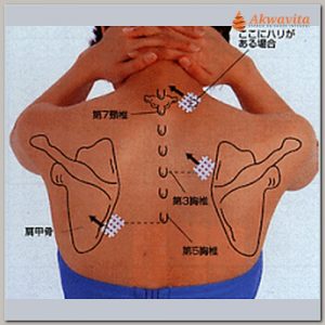 B Esparadrapoterapia Spiral e Kinesio Tira Dores