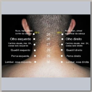 Curso Acupuntura Brasileira Abdominal Cervical Dorsal e Membros